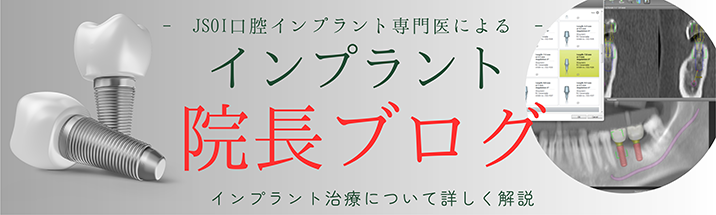 インプラントブログ