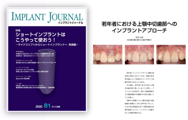 インプラントジャーナル 81号