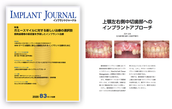 インプラントジャーナル 83号