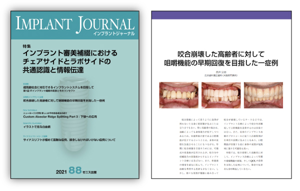 インプラントジャーナル 88号