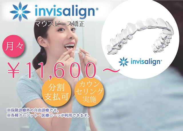 気になるインビザラインの費用は？