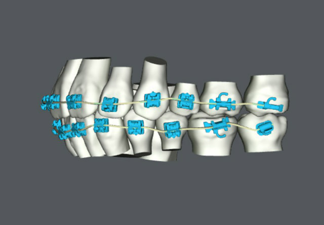 suresmile